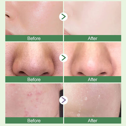 Ursoulney Green Tea Mask Stick for Face Mask